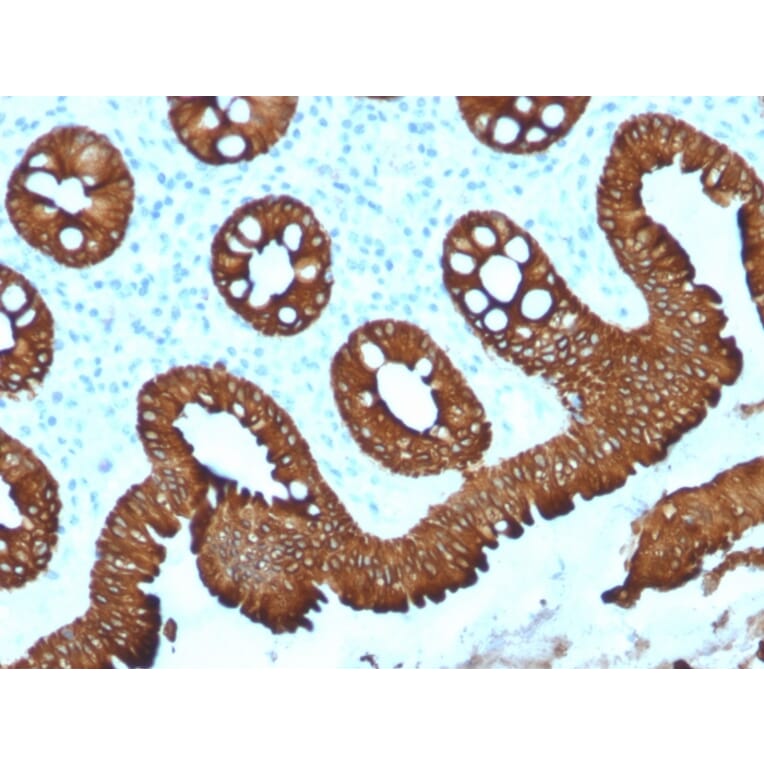 Immunohistochemistry - Anti-Cytokeratin 20 Antibody [KRT20/1992] - BSA and Azide free (A252850) - Antibodies.com