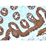 Immunohistochemistry - Anti-Cytokeratin 20 Antibody [KRT20/1992] - BSA and Azide free (A252850) - Antibodies.com