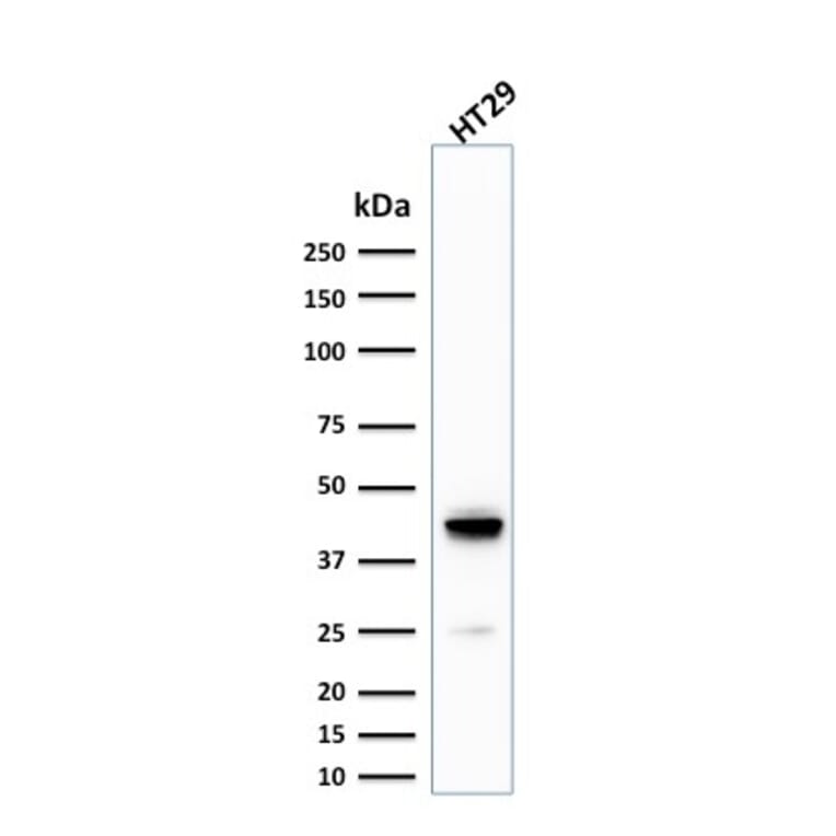 Western Blot - Anti-Cytokeratin 20 Antibody [KRT20/1992] - BSA and Azide free (A252850) - Antibodies.com