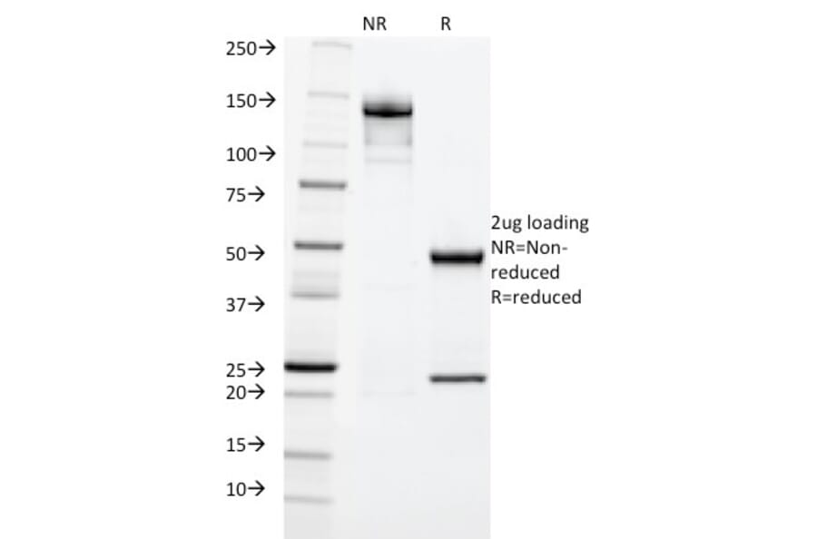 SDS-PAGE - Anti-Cytokeratin 20 Antibody [KRT20/1992] - BSA and Azide free (A252850) - Antibodies.com