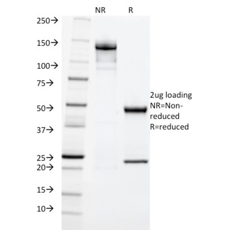SDS-PAGE - Anti-Cytokeratin 20 Antibody [KRT20/1992] - BSA and Azide free (A252850) - Antibodies.com