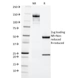 SDS-PAGE - Anti-Cytokeratin 20 Antibody [KRT20/1992] - BSA and Azide free (A252850) - Antibodies.com