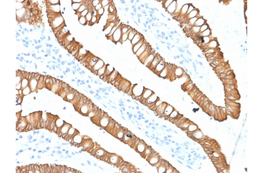 Immunohistochemistry - Anti-Cytokeratin 20 Antibody [SPM140] - BSA and Azide free (A252850) - Antibodies.com