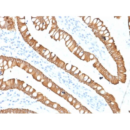 Immunohistochemistry - Anti-Cytokeratin 20 Antibody [SPM140] - BSA and Azide free (A252850) - Antibodies.com