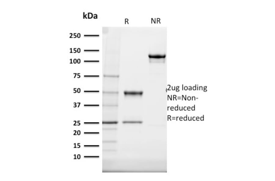 SDS-PAGE - Anti-Cytokeratin 20 Antibody [SPM140] - BSA and Azide free (A252851) - Antibodies.com