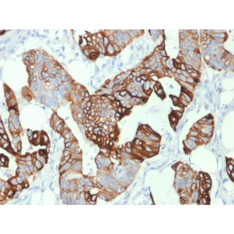 Immunohistochemistry - Anti-Cytokeratin 20 Antibody [KRT20/1993] - BSA and Azide free (A252852) - Antibodies.com