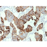 Immunohistochemistry - Anti-Cytokeratin 20 Antibody [KRT20/1993] - BSA and Azide free (A252852) - Antibodies.com