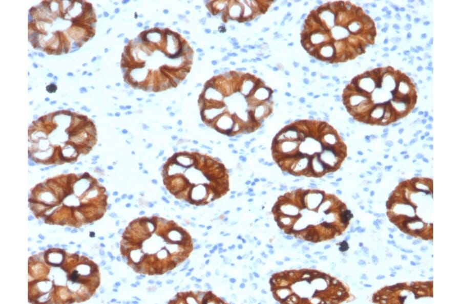 Immunohistochemistry - Anti-Cytokeratin 20 Antibody [KRT20/1993] - BSA and Azide free (A252852) - Antibodies.com
