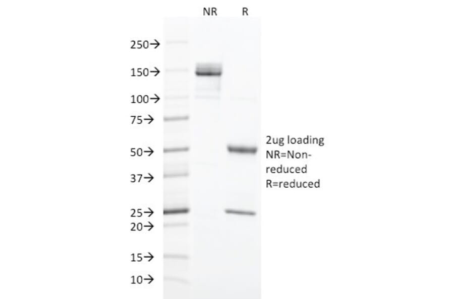 SDS-PAGE - Anti-Cytokeratin 20 Antibody [KRT20/1993] - BSA and Azide free (A252852) - Antibodies.com
