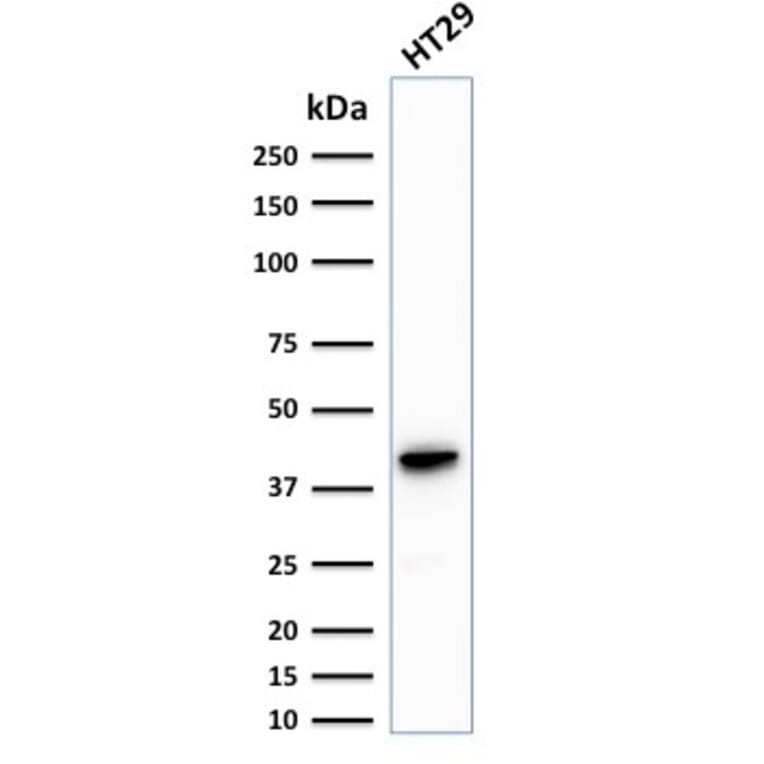 Western Blot - Anti-Cytokeratin 20 Antibody [KRT20/1993] - BSA and Azide free (A252852) - Antibodies.com