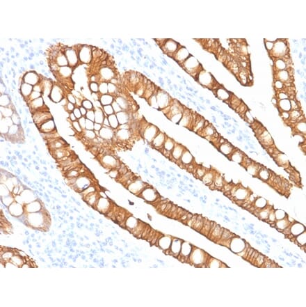 Immunohistochemistry - Anti-Cytokeratin 20 Antibody [SPM191] - BSA and Azide free (A252852) - Antibodies.com