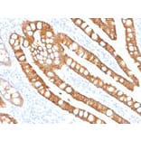 Immunohistochemistry - Anti-Cytokeratin 20 Antibody [SPM191] - BSA and Azide free (A252852) - Antibodies.com