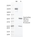 SDS-PAGE - Anti-Cytokeratin 20 Antibody [SPM191] - BSA and Azide free (A252853) - Antibodies.com
