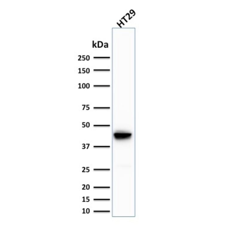 Western Blot - Anti-Cytokeratin 20 Antibody [SPM191] - BSA and Azide free (A252853) - Antibodies.com