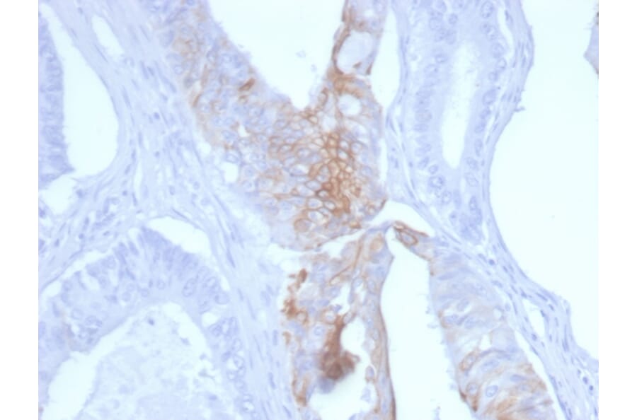 Immunohistochemistry - Anti-Cytokeratin 20 Antibody [KRT20/3145] - BSA and Azide free (A252854) - Antibodies.com