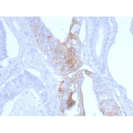 Immunohistochemistry - Anti-Cytokeratin 20 Antibody [KRT20/3145] - BSA and Azide free (A252854) - Antibodies.com