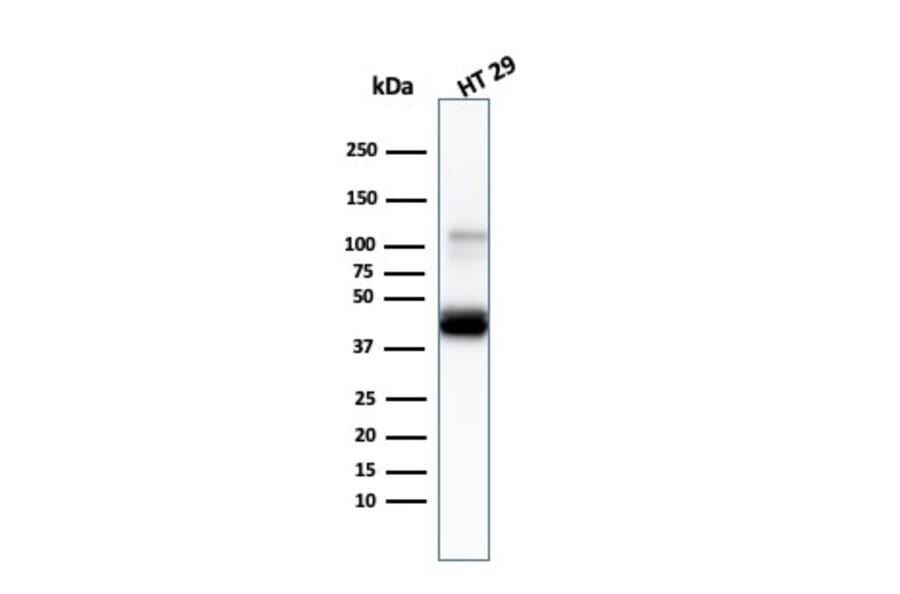 Western Blot - Anti-Cytokeratin 20 Antibody [KRT20/3145] - BSA and Azide free (A252854) - Antibodies.com