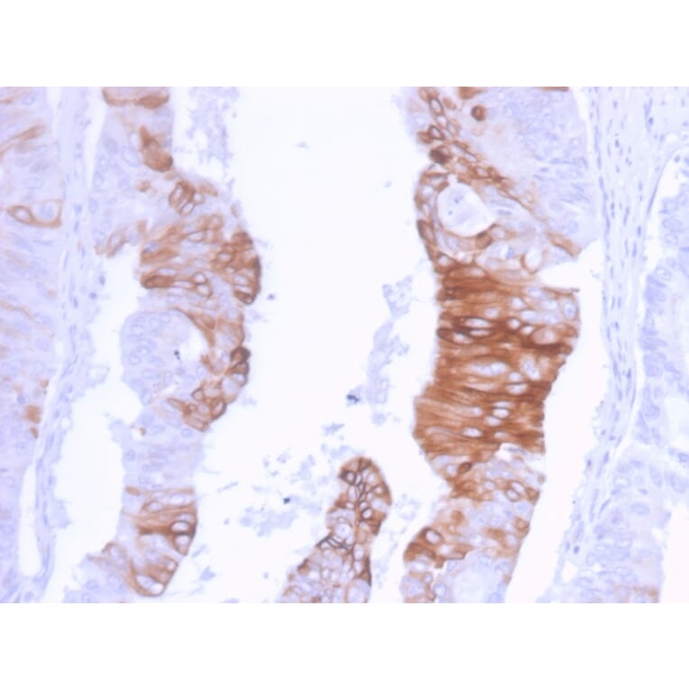Immunohistochemistry - Anti-Cytokeratin 20 Antibody [KRT20/3129R] - BSA and Azide free (A252854) - Antibodies.com