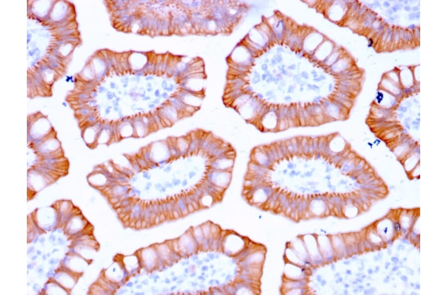 Immunohistochemistry - Anti-Cytokeratin 20 Antibody [KRT20/3129R] - BSA and Azide free (A252855) - Antibodies.com