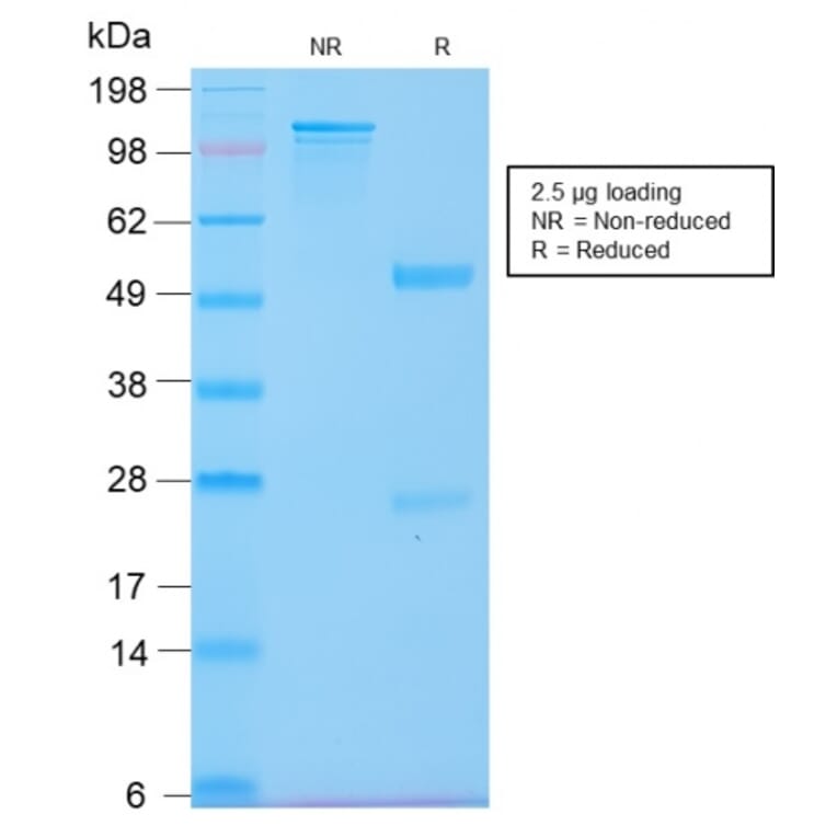 SDS-PAGE - Anti-Cytokeratin 20 Antibody [KRT20/3129R] - BSA and Azide free (A252855) - Antibodies.com