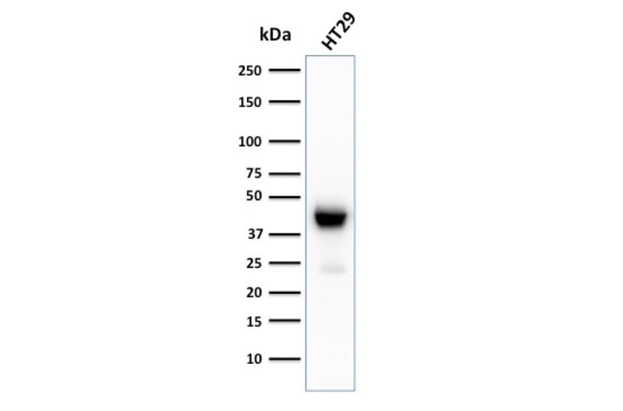 Western Blot - Anti-Cytokeratin 20 Antibody [KRT20/3129R] - BSA and Azide free (A252855) - Antibodies.com