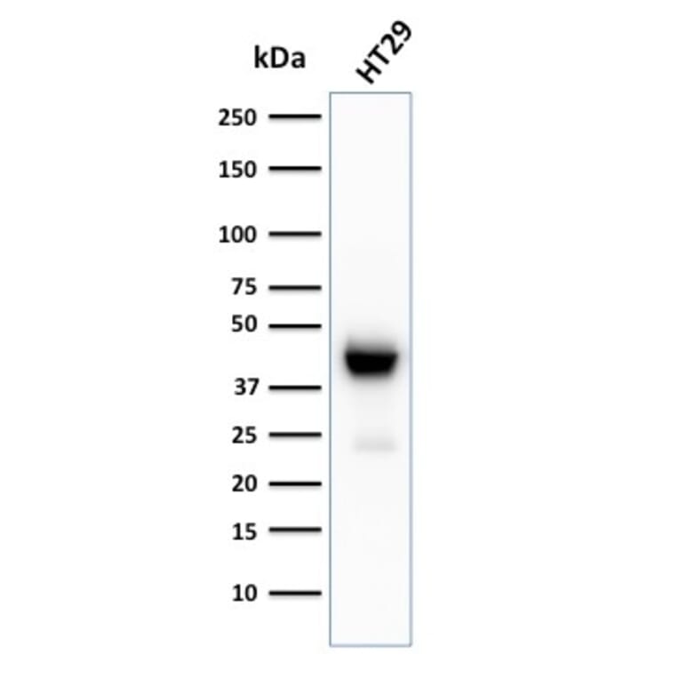 Western Blot - Anti-Cytokeratin 20 Antibody [KRT20/3129R] - BSA and Azide free (A252855) - Antibodies.com