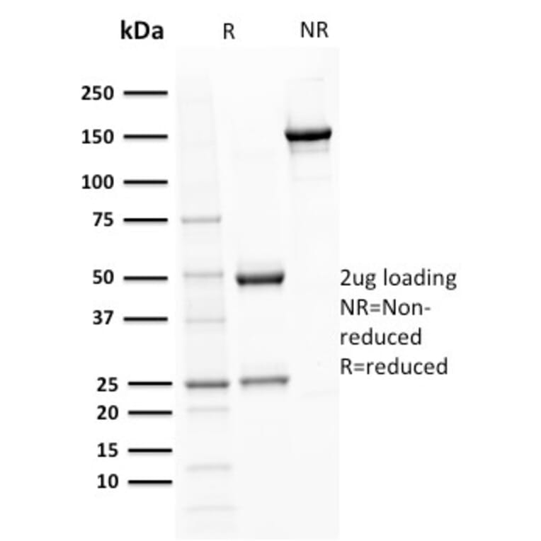 SDS-PAGE - Anti-BOB1 Antibody [BOB1/2421] - BSA and Azide free (A252856) - Antibodies.com