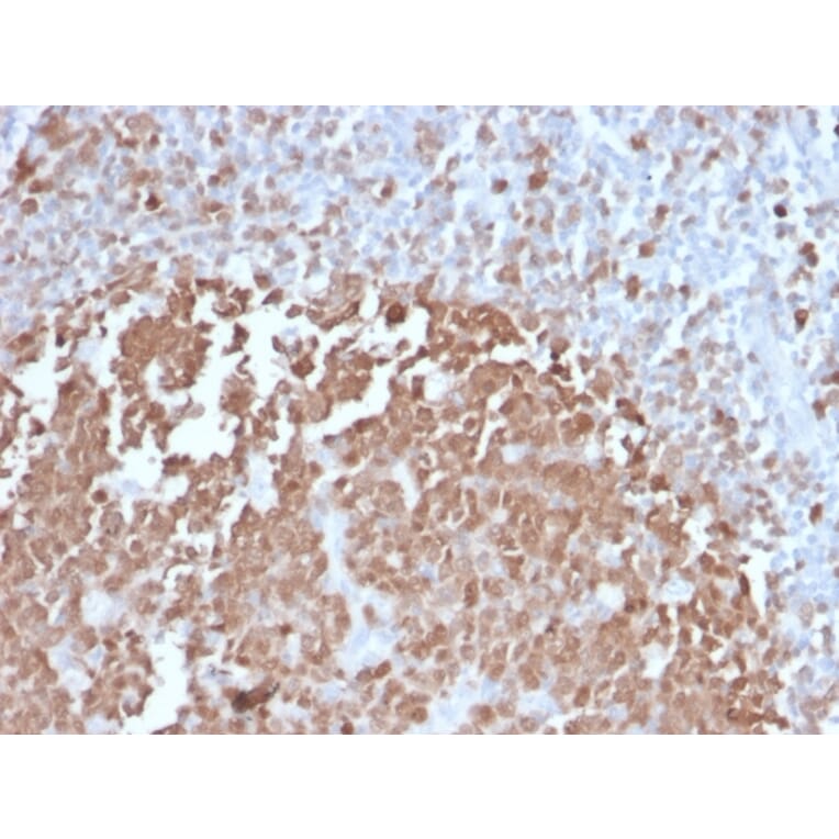 Immunohistochemistry - Anti-BOB1 Antibody [BOB1/2422] - BSA and Azide free (A252857) - Antibodies.com