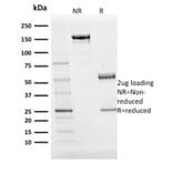 SDS-PAGE - Anti-BOB1 Antibody [BOB1/2424] - BSA and Azide free (A252859) - Antibodies.com