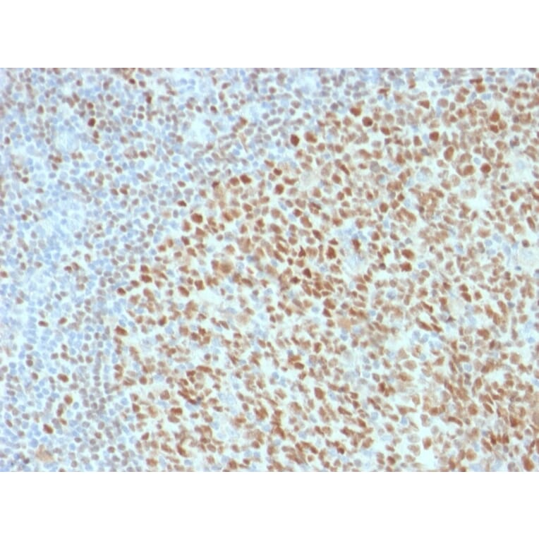 Immunohistochemistry - Anti-OCT-2 Antibody [Oct2/2136] - BSA and Azide free (A252861) - Antibodies.com