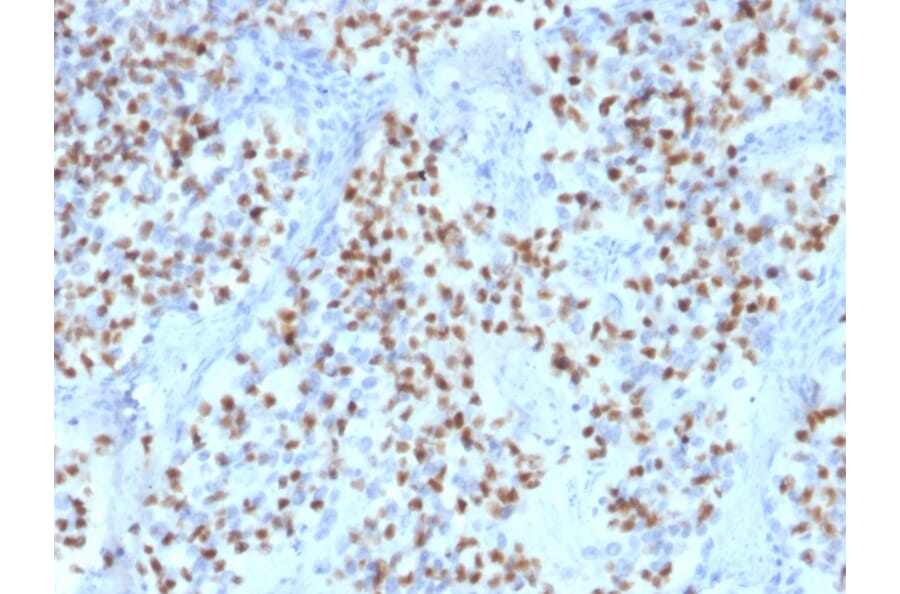 Immunohistochemistry - Anti-OCT-2 Antibody [Oct2/2136] - BSA and Azide free (A252861) - Antibodies.com