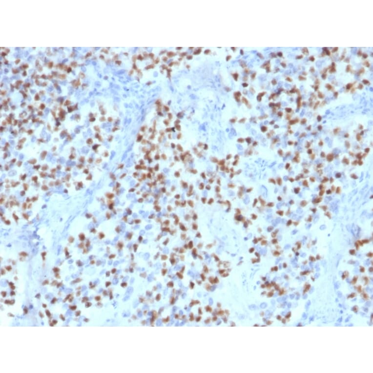 Immunohistochemistry - Anti-OCT-2 Antibody [Oct2/2136] - BSA and Azide free (A252861) - Antibodies.com