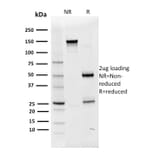 SDS-PAGE - Anti-OCT-2 Antibody [Oct2/2136] - BSA and Azide free (A252861) - Antibodies.com
