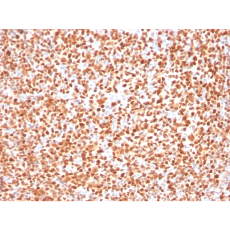 Immunohistochemistry - Anti-OCT-2 Antibody [Oct2/2137] - BSA and Azide free (A252862) - Antibodies.com
