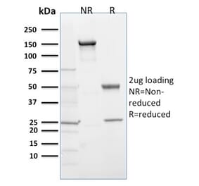 SDS-PAGE - Anti-PHD2 Antibody [366G/76/3] - BSA and Azide free (A252862) - Antibodies.com