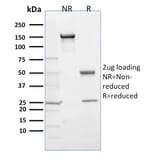 SDS-PAGE - Anti-PHD2 Antibody [366G/76/3] - BSA and Azide free (A252862) - Antibodies.com