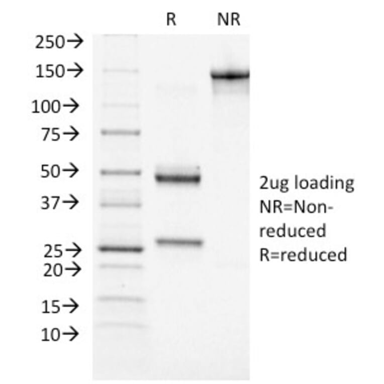 SDS-PAGE - Anti-ATRX Antibody [39f] - BSA and Azide free (A252864) - Antibodies.com