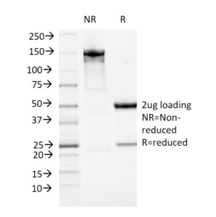 SDS-PAGE - Anti-ATRX Antibody [23c] - BSA and Azide free (A252864) - Antibodies.com