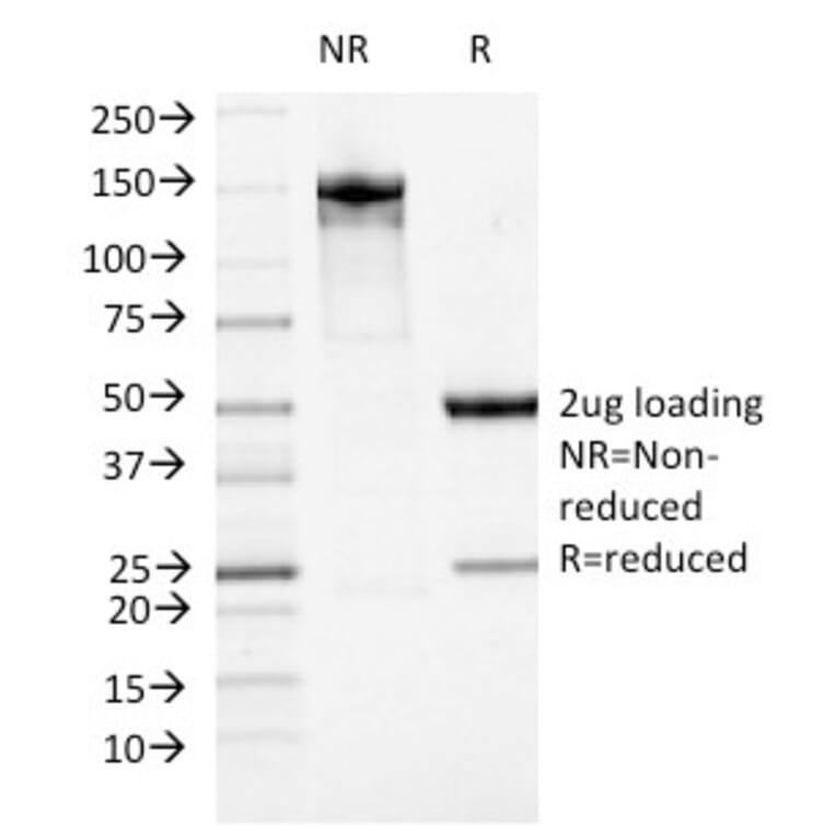 SDS-PAGE - Anti-ATRX Antibody [23c] - BSA and Azide free (A252864) - Antibodies.com