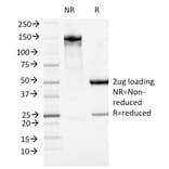 SDS-PAGE - Anti-ATRX Antibody [23c] - BSA and Azide free (A252864) - Antibodies.com