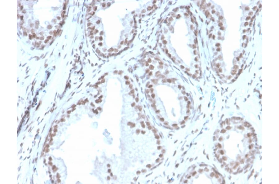 Immunohistochemistry - Anti-ATRX Antibody [rATRX/3446] - BSA and Azide free (A252865) - Antibodies.com