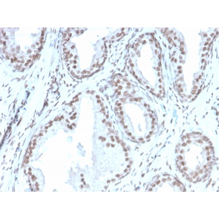 Immunohistochemistry - Anti-ATRX Antibody [rATRX/3446] - BSA and Azide free (A252865) - Antibodies.com