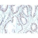 Immunohistochemistry - Anti-ATRX Antibody [rATRX/3446] - BSA and Azide free (A252865) - Antibodies.com