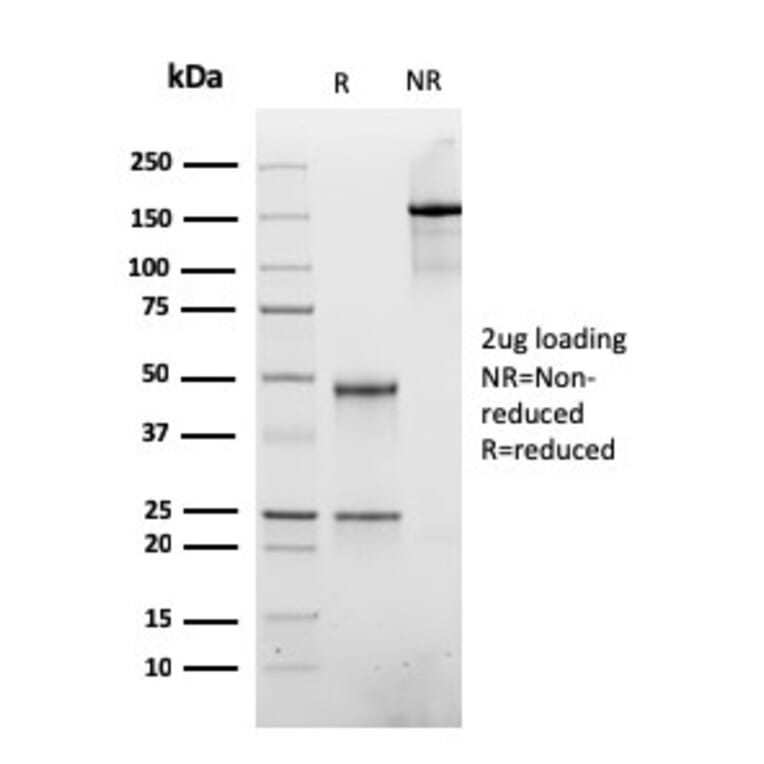 SDS-PAGE - Anti-ATRX Antibody [rATRX/3446] - BSA and Azide free (A252866) - Antibodies.com