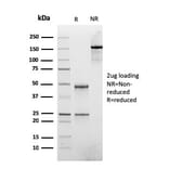 SDS-PAGE - Anti-ATRX Antibody [rATRX/3446] - BSA and Azide free (A252866) - Antibodies.com