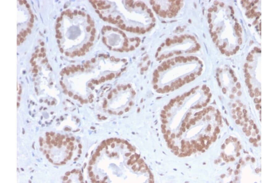 Immunohistochemistry - Anti-ATRX Antibody [ATRX/2900R] - BSA and Azide free (A252866) - Antibodies.com