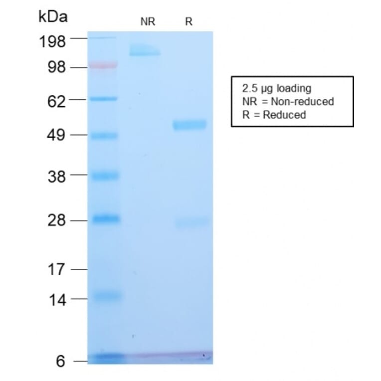 SDS-PAGE - Anti-ATRX Antibody [ATRX/2900R] - BSA and Azide free (A252867) - Antibodies.com