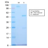 SDS-PAGE - Anti-ATRX Antibody [ATRX/2900R] - BSA and Azide free (A252867) - Antibodies.com