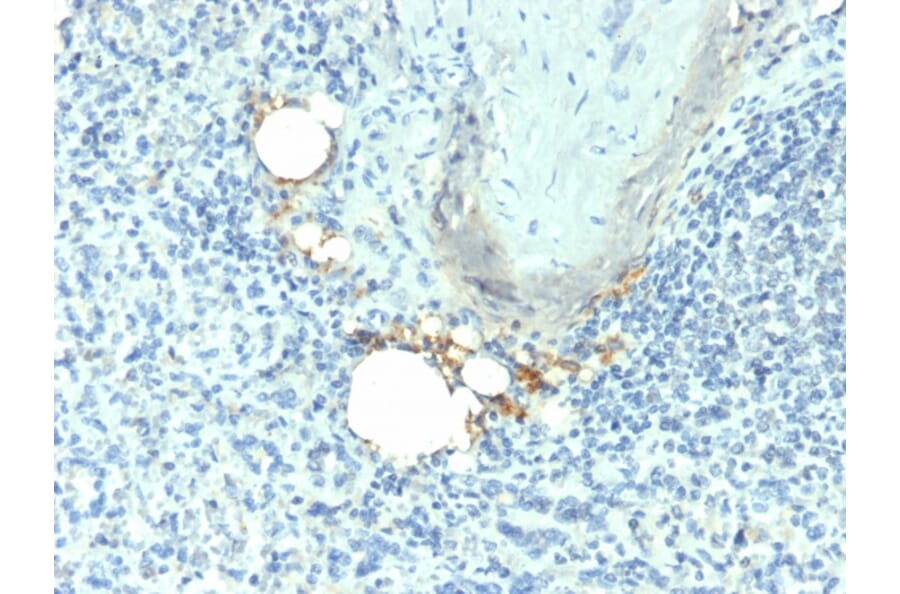 Immunohistochemistry - Anti-Tartrate Resistant Acid Phosphatase Antibody [ACP5/1070] - BSA and Azide free (A252867) - Antibodies.com