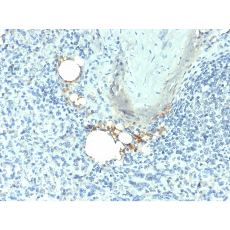 Immunohistochemistry - Anti-Tartrate Resistant Acid Phosphatase Antibody [ACP5/1070] - BSA and Azide free (A252867) - Antibodies.com